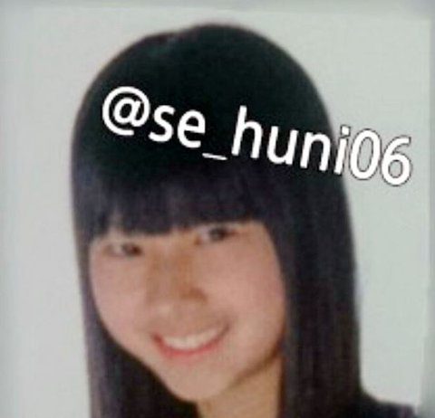 Japanese K-pop Idols’s Plastic Surgery Gains Attention